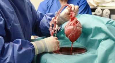 Man gets genetically-modified pig heart in world-first transplant